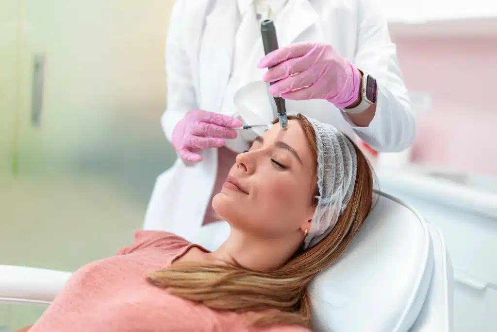 Close up of a woman is long blond hair getting a microneedling treatment.