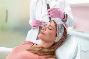 Close up of a woman is long blond hair getting a microneedling treatment.